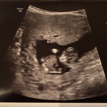 32294435_1883152521737333_6076686190428291072_n